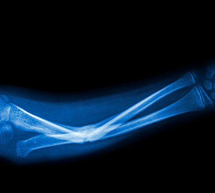 dolor sit amet, consectetur adipiscing elit