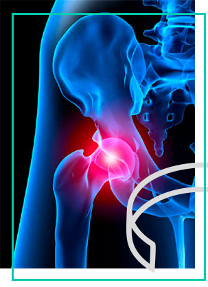 labrum-acetabular